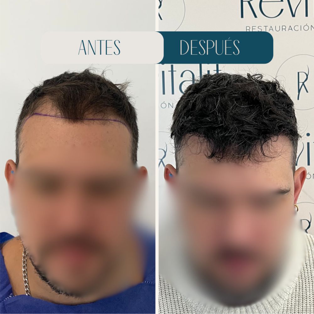 Resultado Revitalit