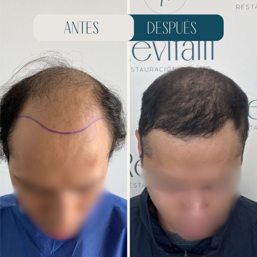 Resultado Revitalit
