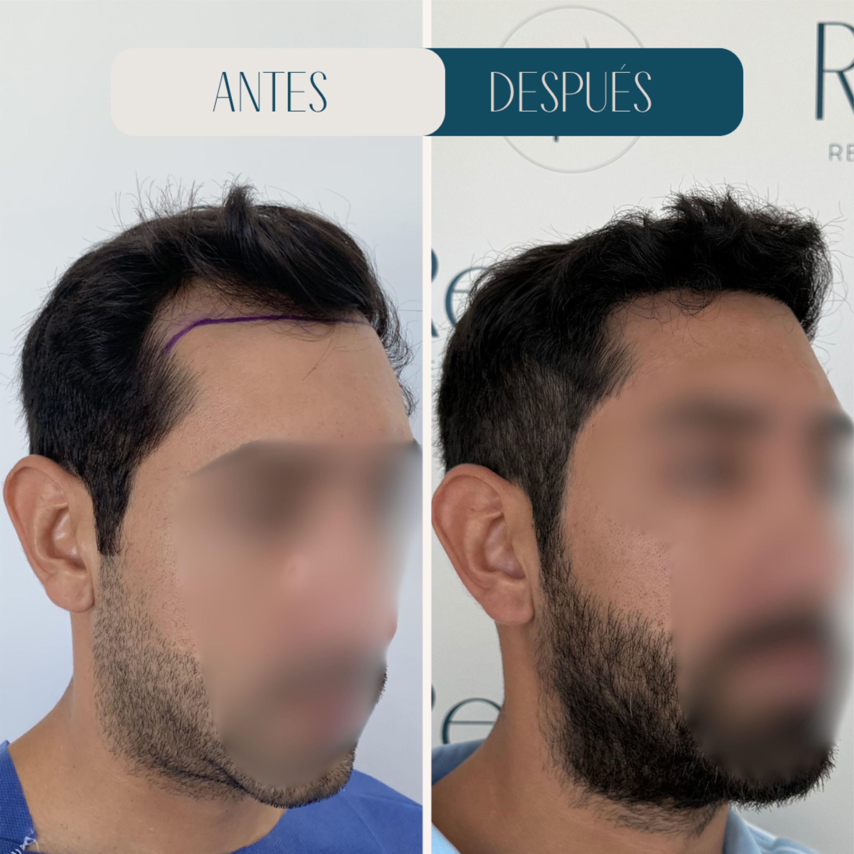 Resultado Revitalit