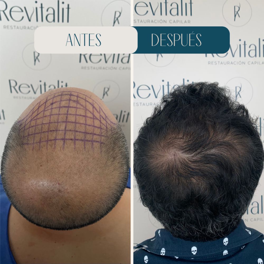 Resultado Revitalit